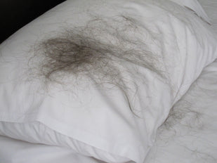 More Hair on Your Pillow